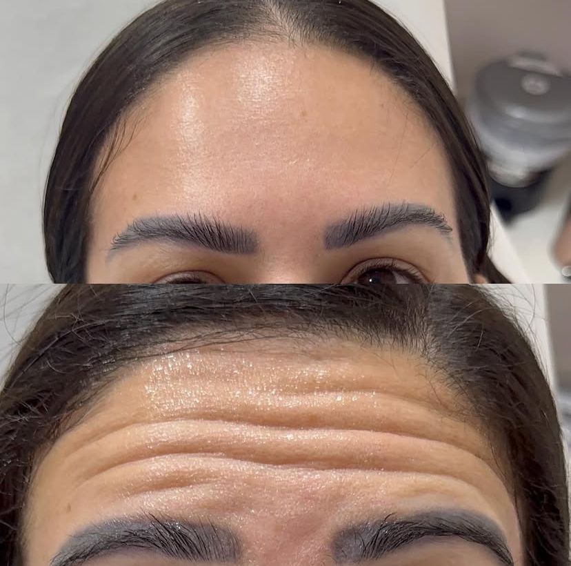 Antes e Depois 2
