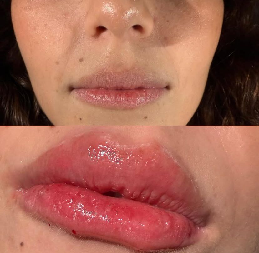 Antes e Depois 3